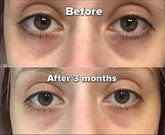 Clear Essence Platinum Skin Lightening under eye Serum 0.5oz / 15ml Clear Essance